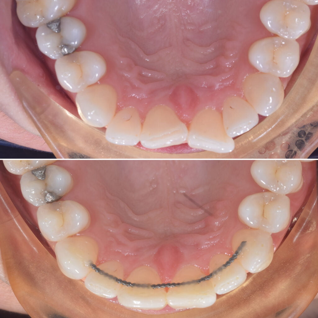 Cosmetic Dentist Halifax Smile Gallery Whitening Huddersfield